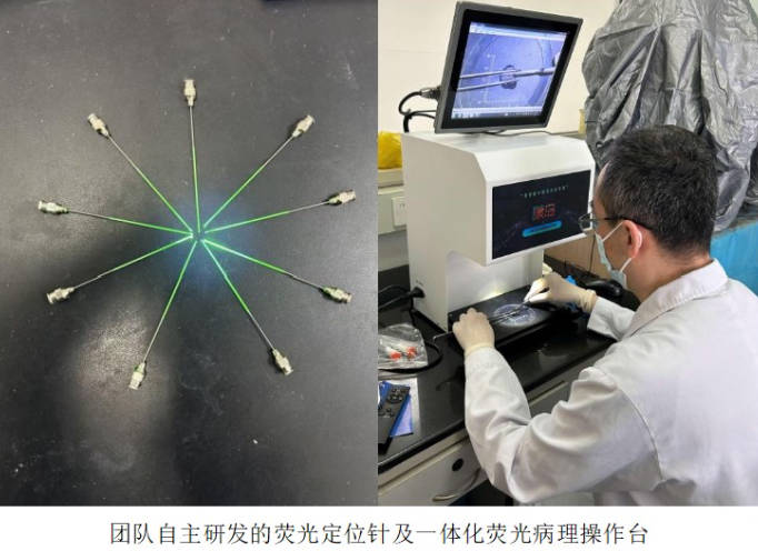 荧光点亮微肿瘤！中国医科大学科创团队为乳管内微肿瘤早期精准诊断提供新方案